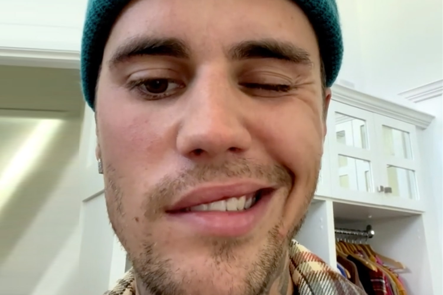 Justin Bieber zbulon procesin e shërimit pas diagnoztifikimit me sindromën Ramsay Hunt